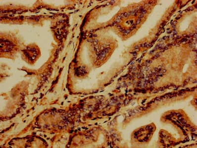 GABARAPL2 / ATG8 Antibody