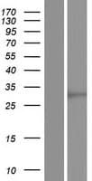SCD5 / SCD4 Protein (Over-Expression Lysate Myc-DDK (Flag))
