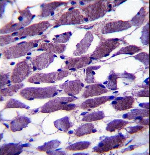 MYOM1 / Myomesin 1 Antibody (aa904-933)