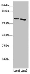 KRT6B / CK6B / Cytokeratin 6B Antibody