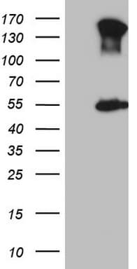 Monoclonal Mouse anti-Human ESRRA / ERR Alpha Antibody (clone OTI2C10, aa1-205, WB)