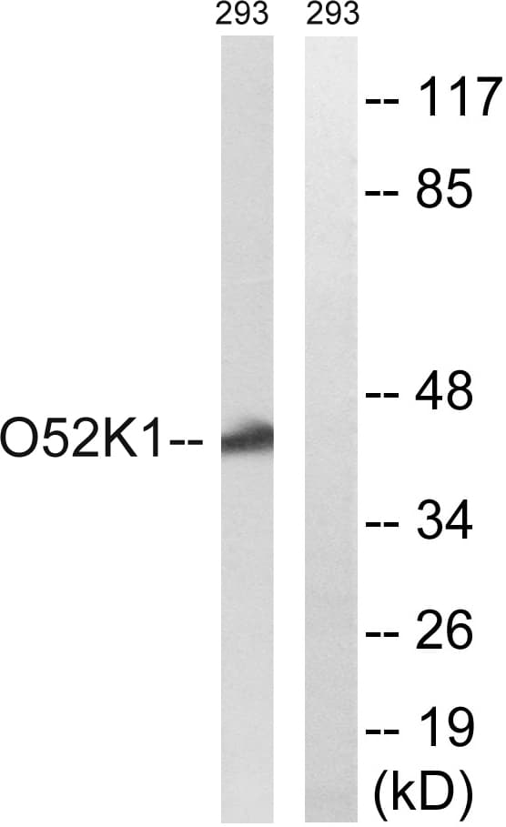 Polyclonal Rabbit anti-Human OR52K1 Antibody (aa201-250, WB)