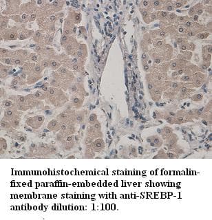 SREBF1 / SREBP-1 Antibody (Internal)