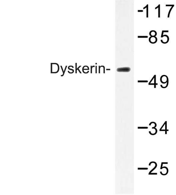 DKC1 / Dyskerin Antibody (Lys203)