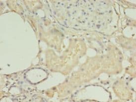 HNRNPL / hnRNP L Antibody (aa89-335, HRP)