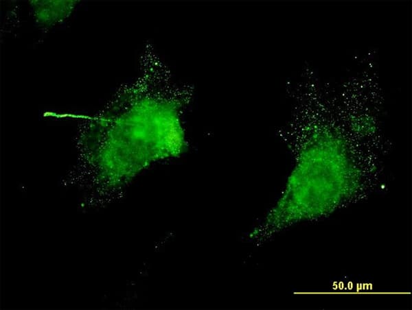 Monoclonal Mouse anti-Human KCNC3 / Kv3.3 Antibody (clone 1C1, IF, WB)