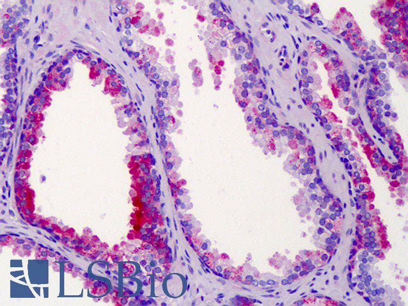 IHC-plus™ Polyclonal Rabbit anti-Human ST14 / Matriptase Antibody (aa10-59, IHC, IF, WB)