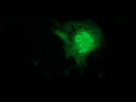 FGF21 Antibody (clone OTI4B4)
