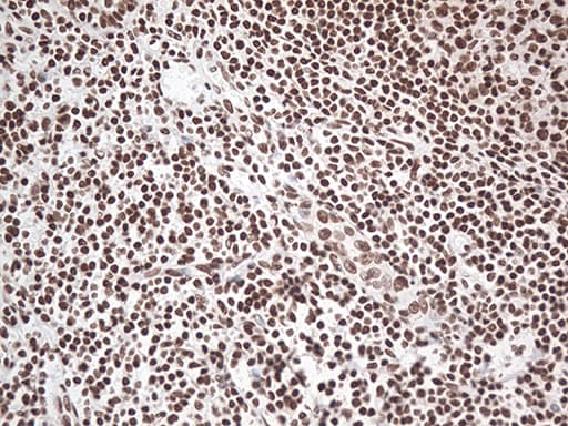 EWSR1 / EWS Antibody (aa256-447, clone OTI2D9, Carrier-free)