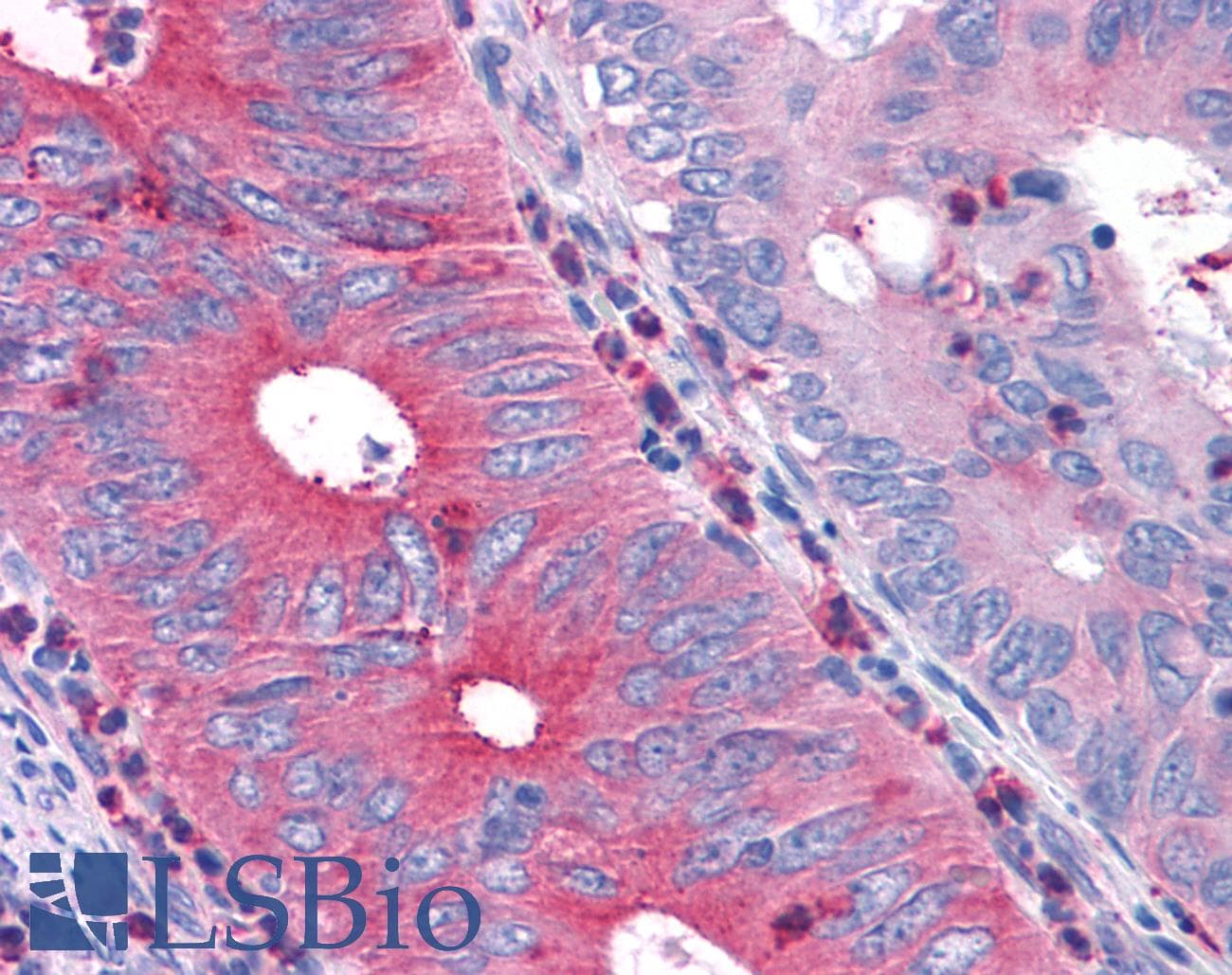 PathPlus™ T1R1 / TAS1R1 Antibody (Cytoplasmic Domain)