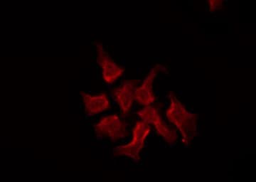ABCC2 / MRP2 Antibody