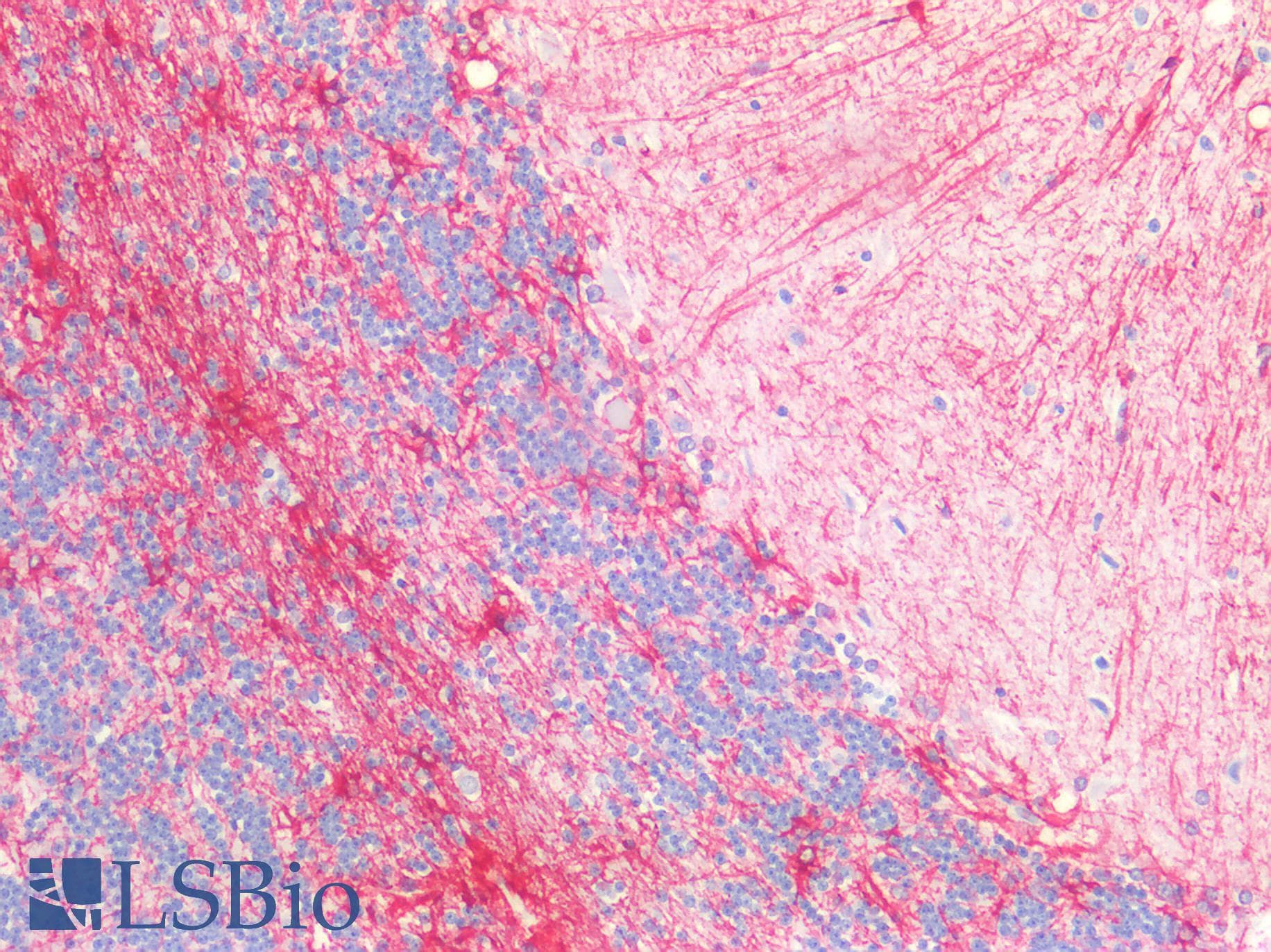 GFAP Antibody (aa1-430)