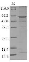 Human CTSO Protein (Recombinant MBP, N-terminus + 6His, C-terminus)
