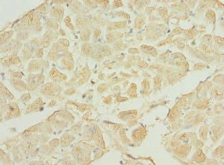 TNNI3K / CARK Antibody