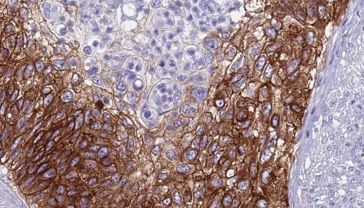 Polyclonal Rabbit anti-Human CLDN4 / Claudin 4 Antibody (IHC, WB)