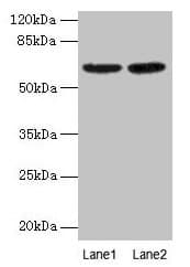 Polyclonal Rabbit anti-Human NELFB / COBRA1 Antibody (IHC, WB)