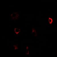 Polyclonal Rabbit anti-Human CBS Antibody (IHC, IF, WB)