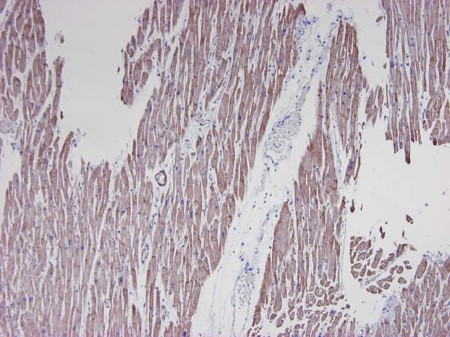 IHC-plus™ Monoclonal Mouse anti-Human Muscle Actin Antibody (clone HHF35, IHC, WB)