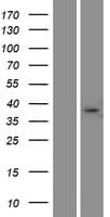 FAM181A Protein (Over-Expression Lysate Myc-DDK (Flag))