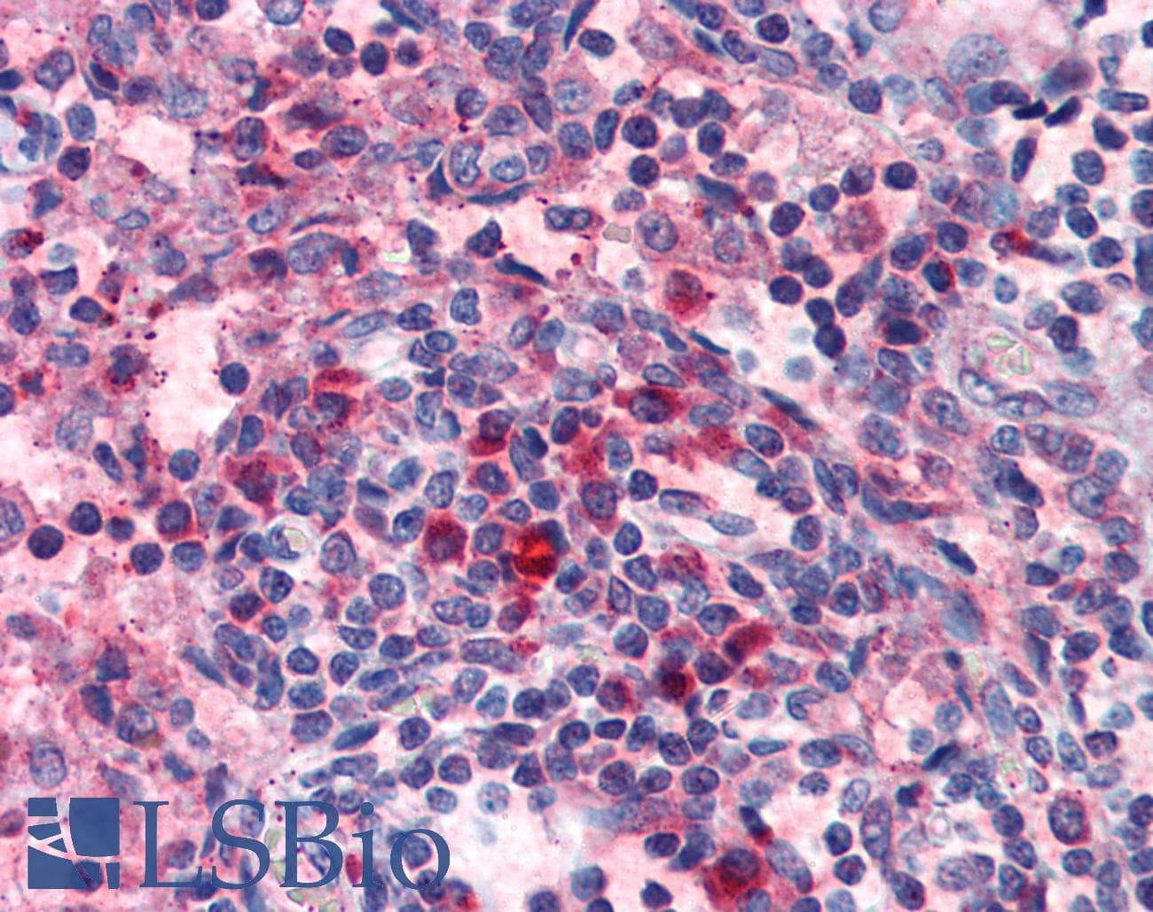 IHC-plus™ Polyclonal Rabbit anti-Human HRH4 / Histamine H4 Receptor Antibody (Extracellular Domain, IHC)