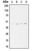 Polyclonal Rabbit anti-Human ACTR3 Antibody (C-Terminus, WB)