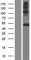 LIPM / LIPL3 Protein (Over-Expression Lysate Myc-DDK (Flag))