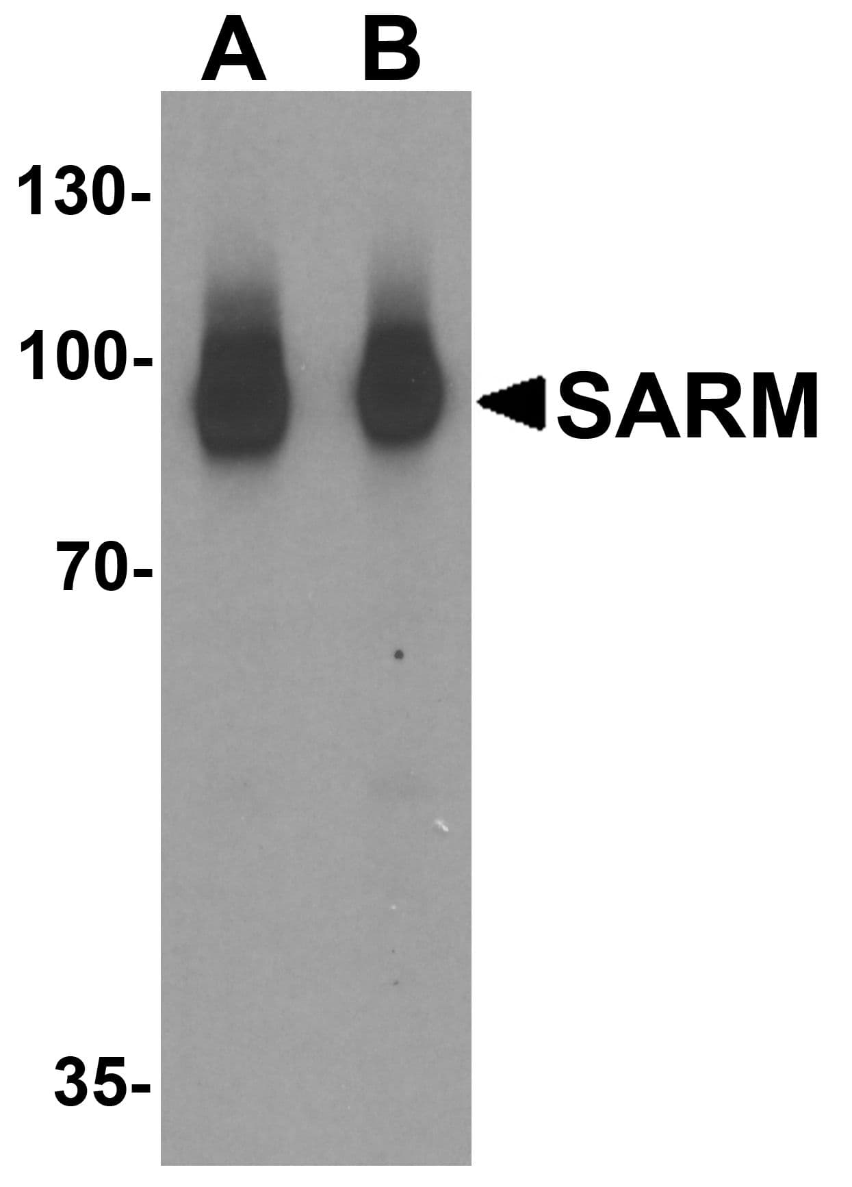SARM1 / SARM Antibody