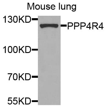 PPP4R4 Antibody