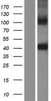 ZPBP / SP38 Protein (Over-Expression Lysate Myc-DDK (Flag))