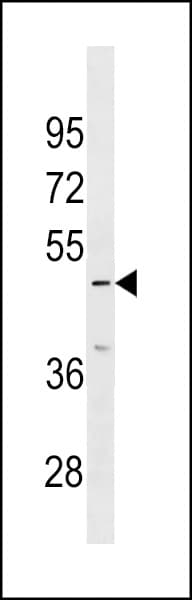 IP6K3 Antibody (aa72-98)