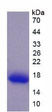 Rat BGN / Biglycan Protein (Recombinant His)