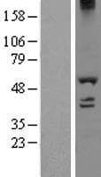 DDX19A Protein (Over-Expression Lysate Myc-DDK (Flag))
