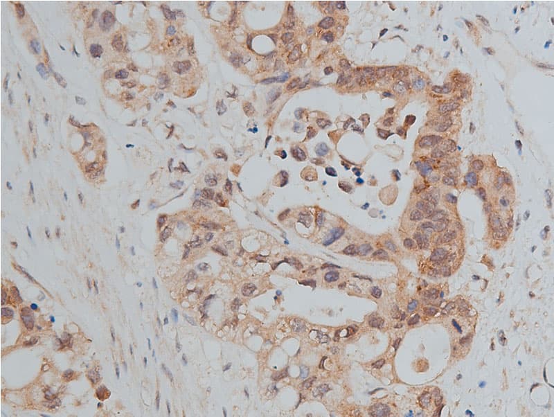Polyclonal Rabbit anti-Human CDH1 / E Cadherin Antibody (IHC, IF, WB)