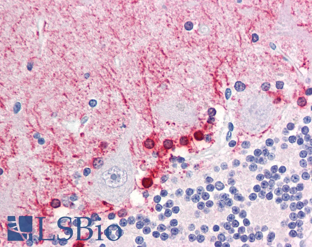 IHC-plus™ Monoclonal Mouse anti-Human FABP7 / BLBP / MRG Antibody (clone AT1D1, aa1-132, IHC, WB)