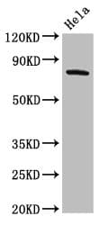 Polyclonal Rabbit anti-Human ADRBK2 / GRK3 Antibody (IHC, WB)