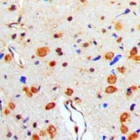 Polyclonal Rabbit anti-Human MAPT / Tau Antibody (phospho-Thr529, IHC, WB)