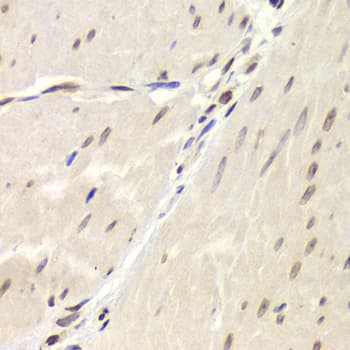 Polyclonal Rabbit anti-Human XRCC6 / Ku70 Antibody (IHC, IF, WB)