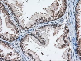 HMRF1L / MTRF1L Antibody (clone OTI2B5)