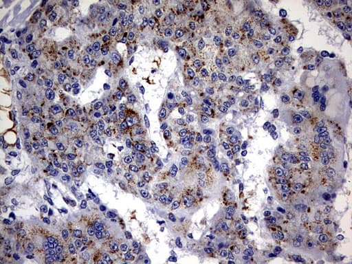 ALDP / ABCD1 Antibody (aa508-745, clone OTI4C2)
