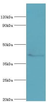 Polyclonal Rabbit anti-Human HDAC8 Antibody (aa1-377, IHC, WB)