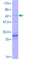 Human CASP3 / Caspase 3 Protein (Recombinant GST)