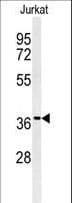 GNB1 Antibody (aa1-30)