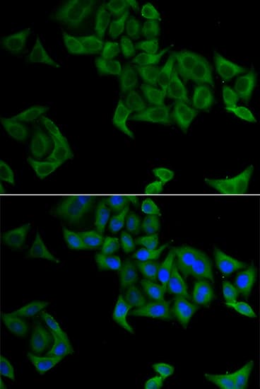 Polyclonal Rabbit anti-Human SMYD5 Antibody (IHC, IF, WB)
