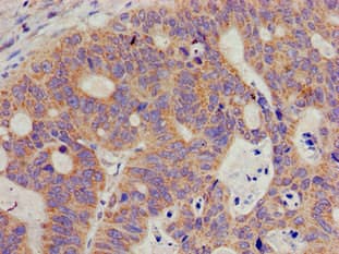 OPRS1 / SIGMAR1 Antibody