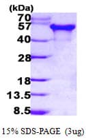 Human MAPT / Tau Protein (Recombinant His)