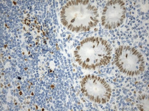 EZH2 Antibody (aa182-431, clone UMAB264)