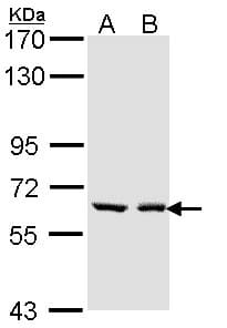 UGT1A6 Antibody