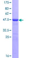 Human Recoverin Protein (Recombinant GST)