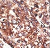 Polyclonal Rabbit anti-Human MMP13 Antibody (aa295-324, IHC, WB)