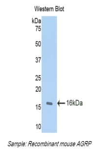 AGRP Antibody (aa21-131)